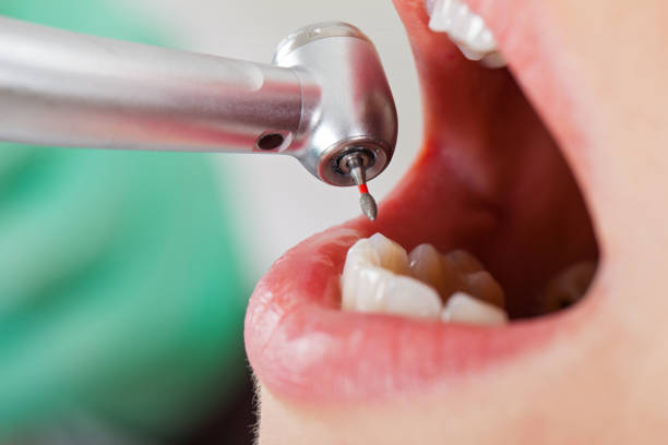 Best Emergency Dental Services for Seniors in Key Biscayne, FL